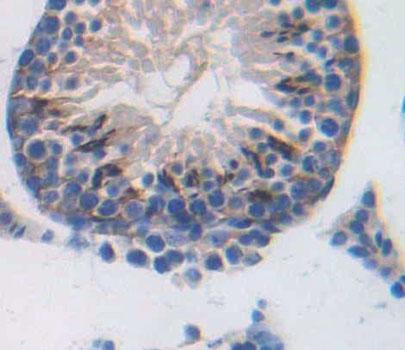 Polyclonal Antibody to Sperm Protein 17 (Sp17)