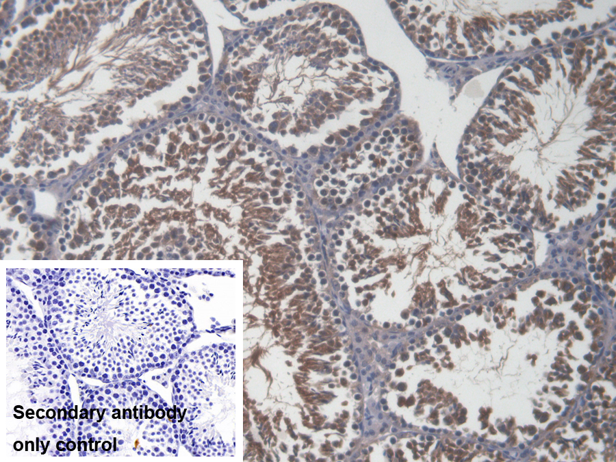 Polyclonal Antibody to Sperm Protein 17 (Sp17)