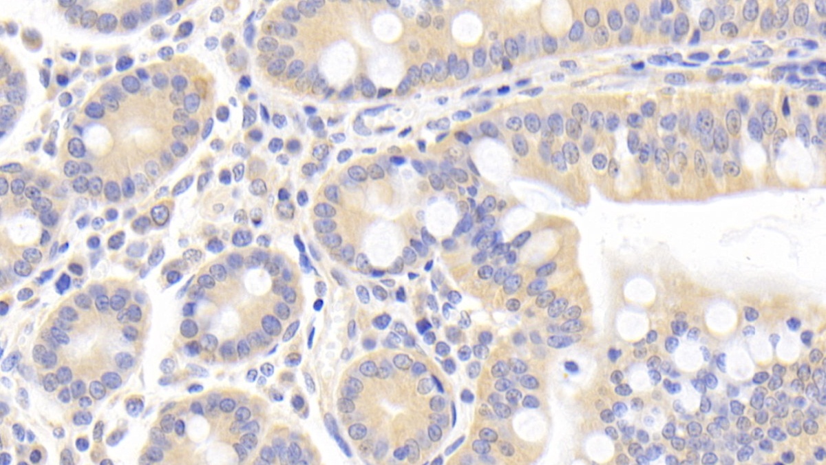 Polyclonal Antibody to Inhibitor Of Nuclear Factor Kappa B Kinase Interacting Protein (IKBIP)