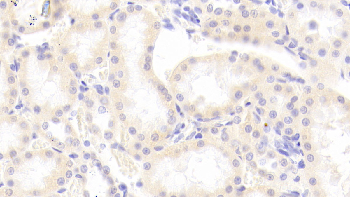 Polyclonal Antibody to Inhibitor Of Nuclear Factor Kappa B Kinase Interacting Protein (IKBIP)