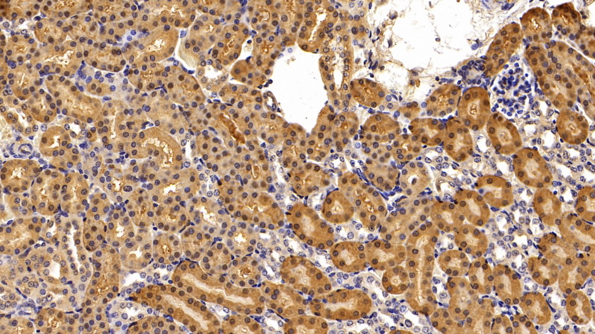 Polyclonal Antibody to Superoxide Dismutase 1 (SOD1)