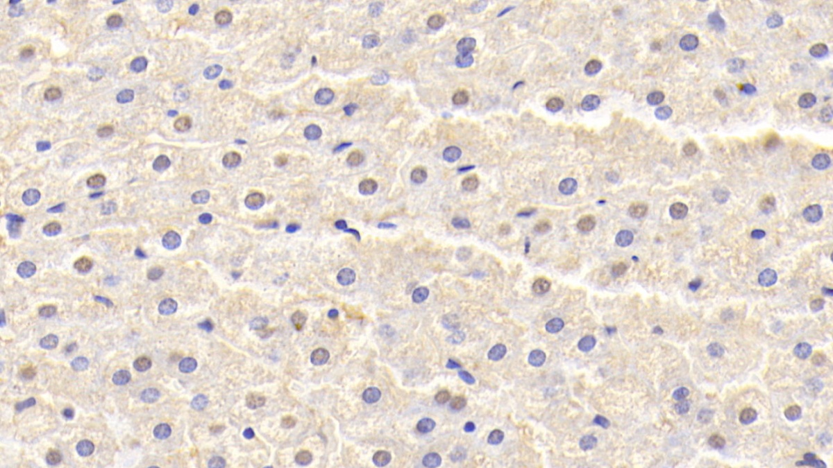 Polyclonal Antibody to Superoxide Dismutase 1 (SOD1)