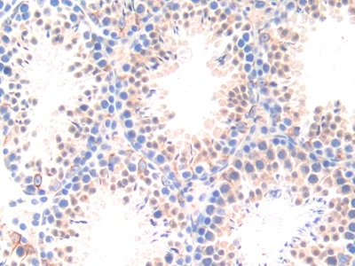 Polyclonal Antibody to Apolipoprotein D (APOD)