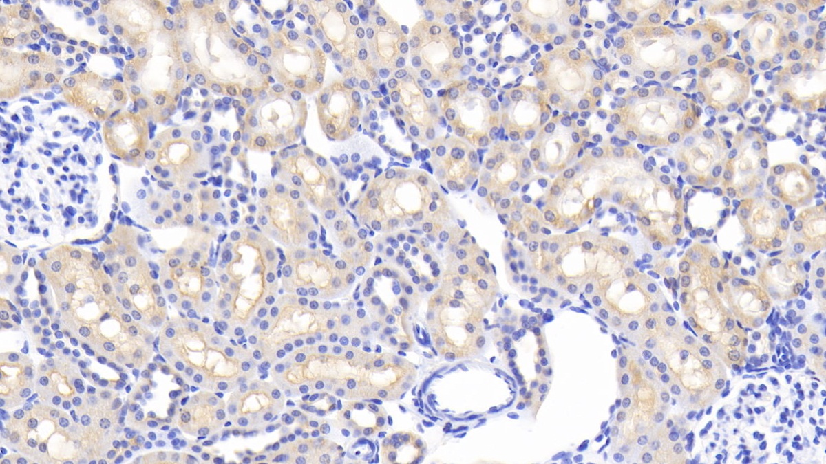 Polyclonal Antibody to Apolipoprotein D (APOD)