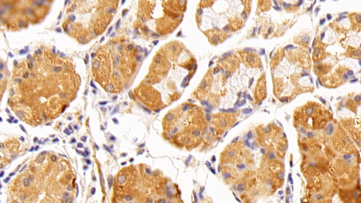 Polyclonal Antibody to Complement Component 5 (C5)