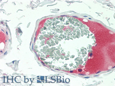 Polyclonal Antibody to Protein S (PROS)