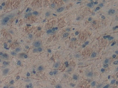 Polyclonal Antibody to Protein S (PROS)