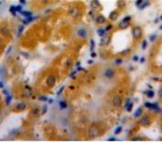 Polyclonal Antibody to A Disintegrin And Metalloproteinase With Thrombospondin 1 (ADAMTS1)