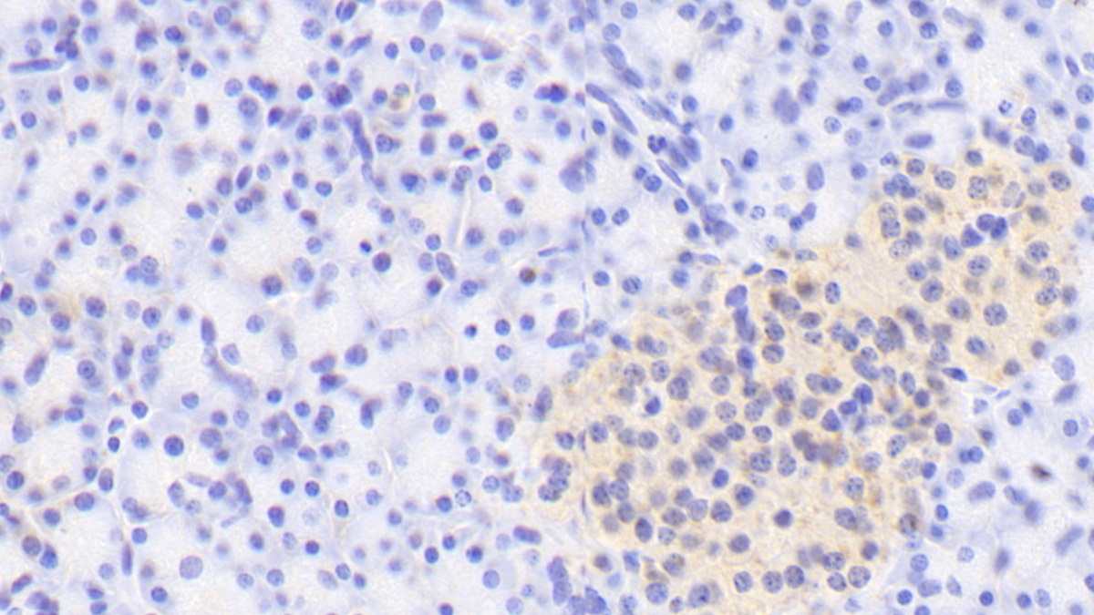 Polyclonal Antibody to A Disintegrin And Metalloproteinase With Thrombospondin 1 (ADAMTS1)