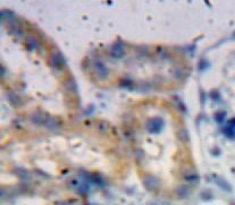 Polyclonal Antibody to A Disintegrin And Metalloproteinase With Thrombospondin 1 (ADAMTS1)