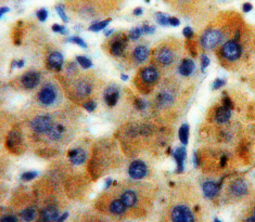 Polyclonal Antibody to A Disintegrin And Metalloproteinase With Thrombospondin 7 (ADAMTS7)