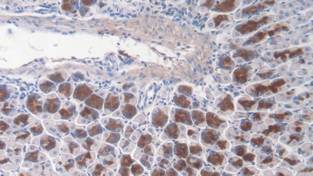 Polyclonal Antibody to Tenascin C (TNC)