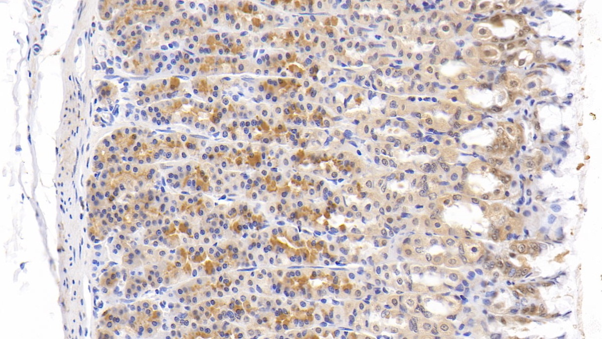 Polyclonal Antibody to Tenascin C (TNC)