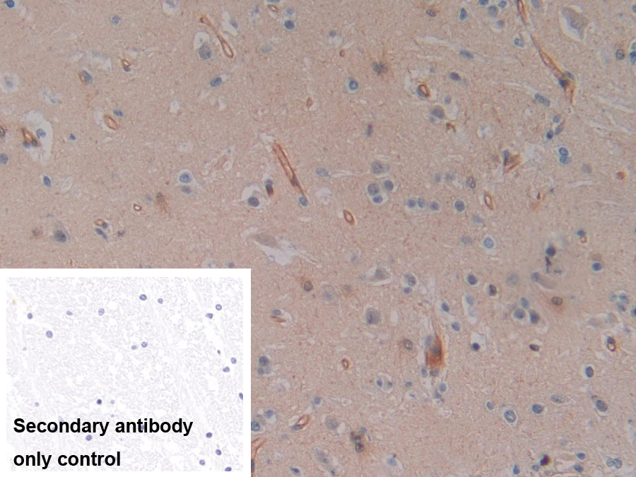 Polyclonal Antibody to Sodium Hydrogen Exchange Regulatory Cofactor 2 (SLC9A3R2)