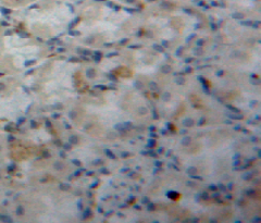 Polyclonal Antibody to Fatty Acid Binding Protein 5 (FABP5)