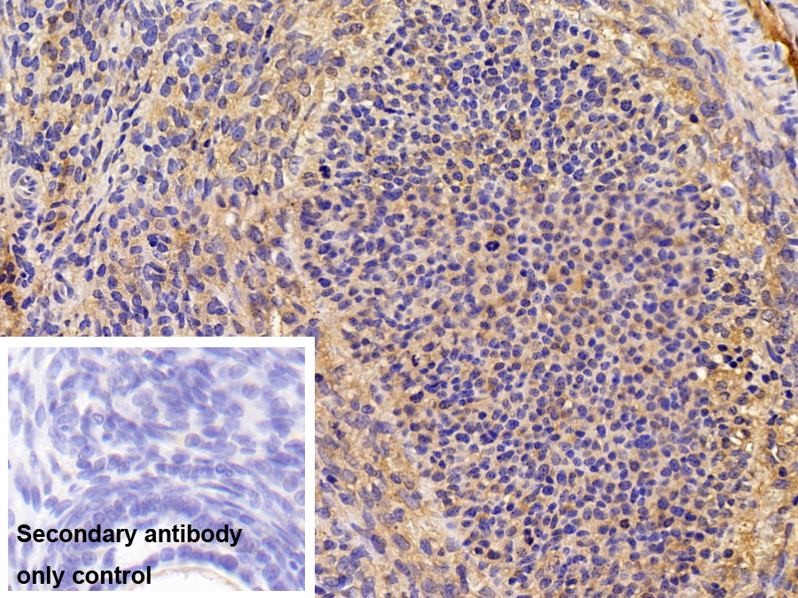 Polyclonal Antibody to Hemopexin (HPX)