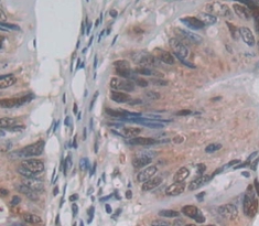 Polyclonal Antibody to Protein Kinase N2 (PKN2)