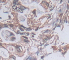 Polyclonal Antibody to Protein Kinase N2 (PKN2)