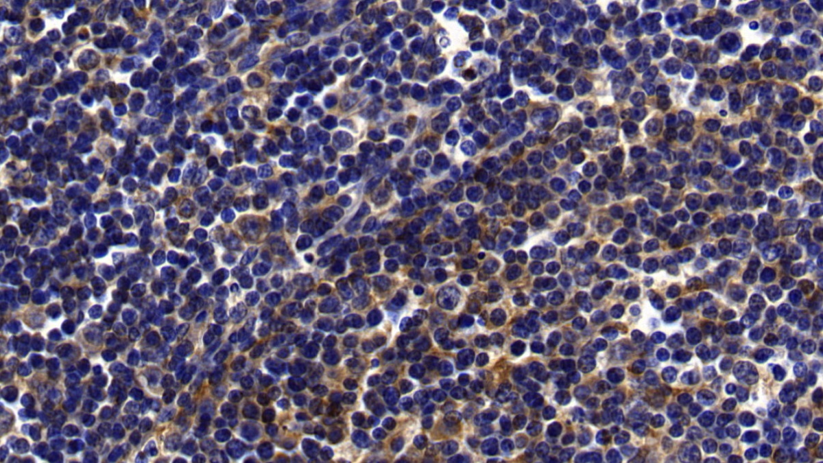 Polyclonal Antibody to Toll Like Receptor 1 (TLR1)