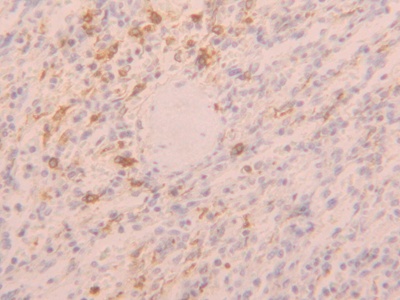 Polyclonal Antibody to Toll Like Receptor 5 (TLR5)