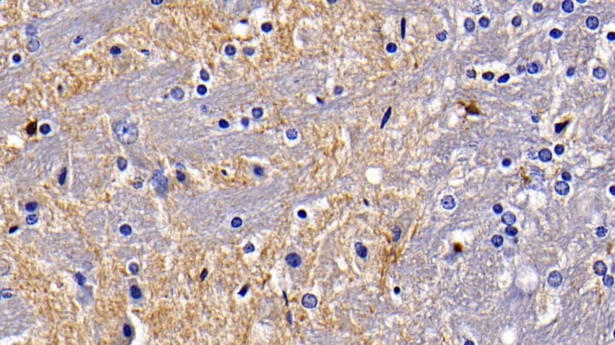 Polyclonal Antibody to Toll Like Receptor 5 (TLR5)