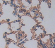 Polyclonal Antibody to Toll Like Receptor 8 (TLR8)