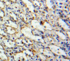 Polyclonal Antibody to Toll Like Receptor 10 (TLR10)