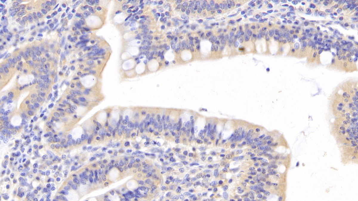 Polyclonal Antibody to Hemojuvelin (HJV)