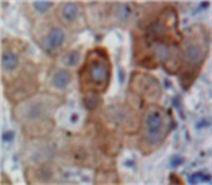 Polyclonal Antibody to Apolipoprotein B (APOB)