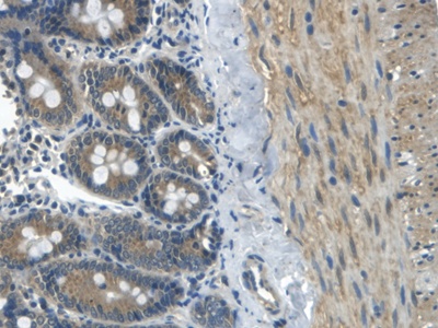 Polyclonal Antibody to Apolipoprotein B (APOB)