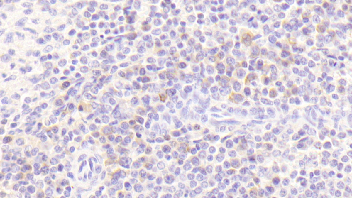 Polyclonal Antibody to Interleukin 8 Receptor Beta (IL8Rb)