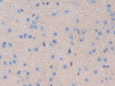 Polyclonal Antibody to Interleukin 35 (IL35)