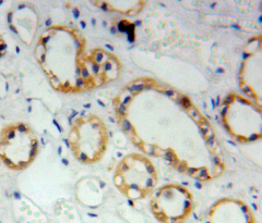 Polyclonal Antibody to S100 Calcium Binding Protein A2 (S100A2)