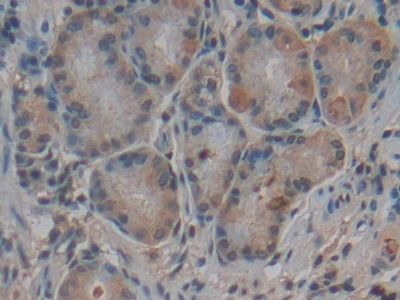 Polyclonal Antibody to Complement Factor B (CFB)