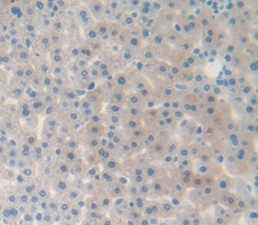 Polyclonal Antibody to Complement Factor B (CFB)