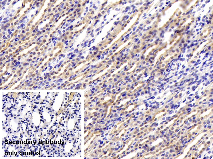 Polyclonal Antibody to Complement Factor B (CFB)