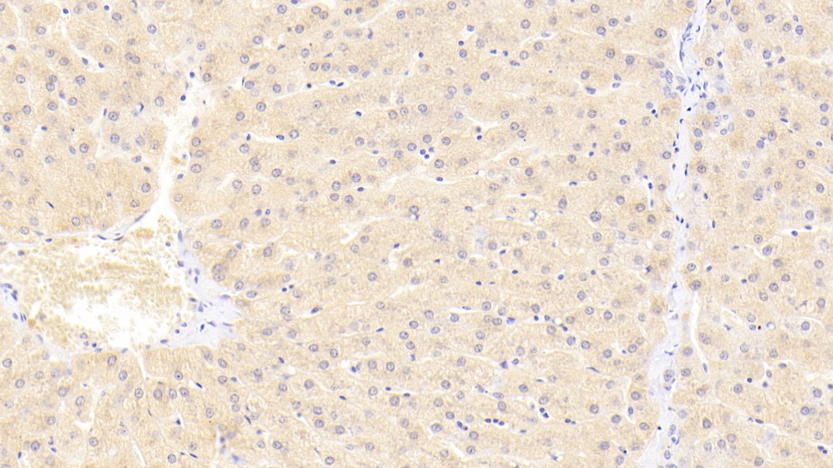 Polyclonal Antibody to Dihydropyrimidine Dehydrogenase (DPYD)