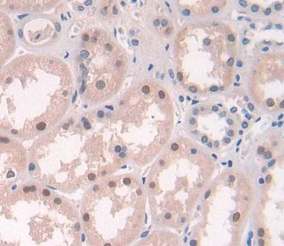 Polyclonal Antibody to Xeroderma Pigmentosum, Complementation Group D (XPD)