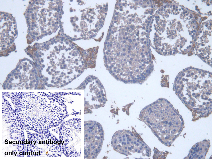 Polyclonal Antibody to Cytochrome P450 17A1 (CYP17A1)