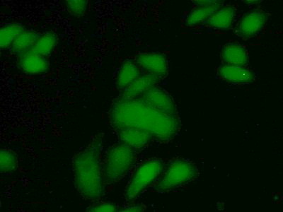 Polyclonal Antibody to S100 Calcium Binding Protein A4 (S100A4)