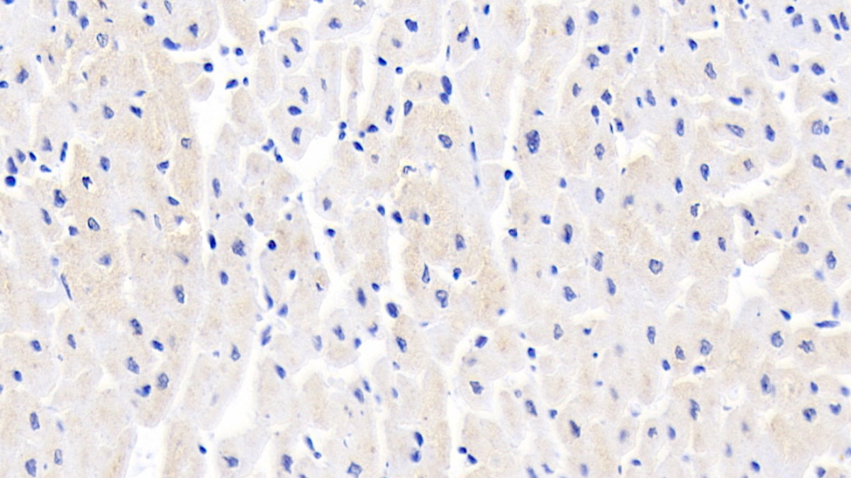 Polyclonal Antibody to Glucose Transporter 4 (GLUT4)