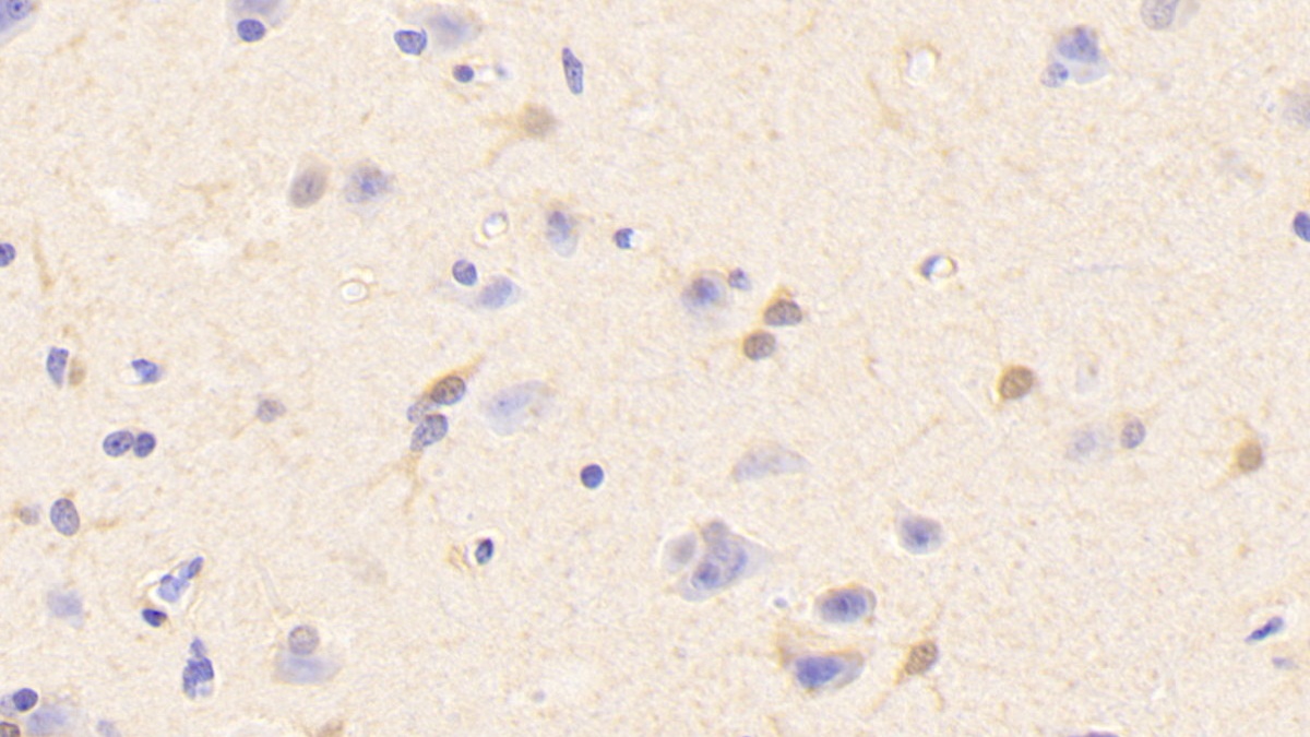 Polyclonal Antibody to Creatine Kinase B (CK-BB)