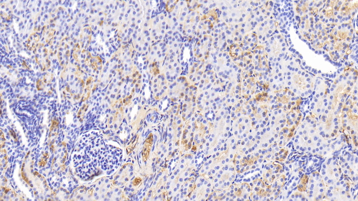 Polyclonal Antibody to Transferrin (TF)