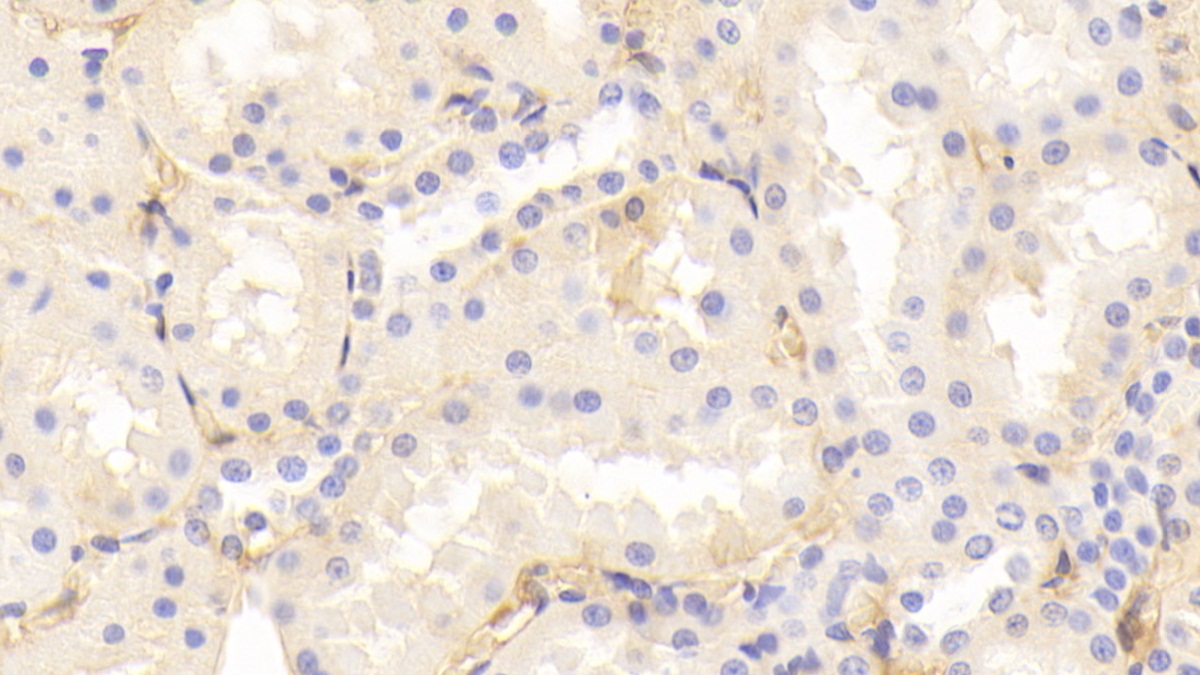 Polyclonal Antibody to Transferrin (TF)