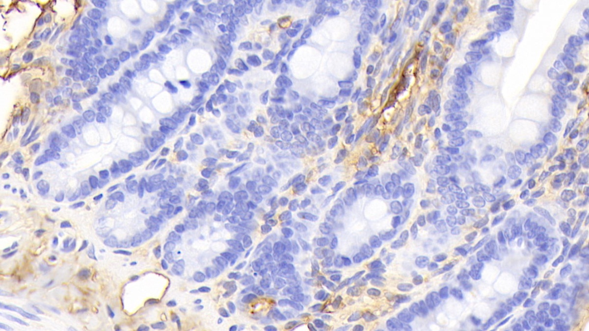 Polyclonal Antibody to Transferrin (TF)