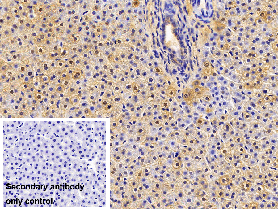 Polyclonal Antibody to Farnesoid X Receptor (FXR)