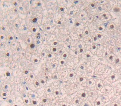 Polyclonal Antibody to Liver X Receptor Alpha (LXRa)