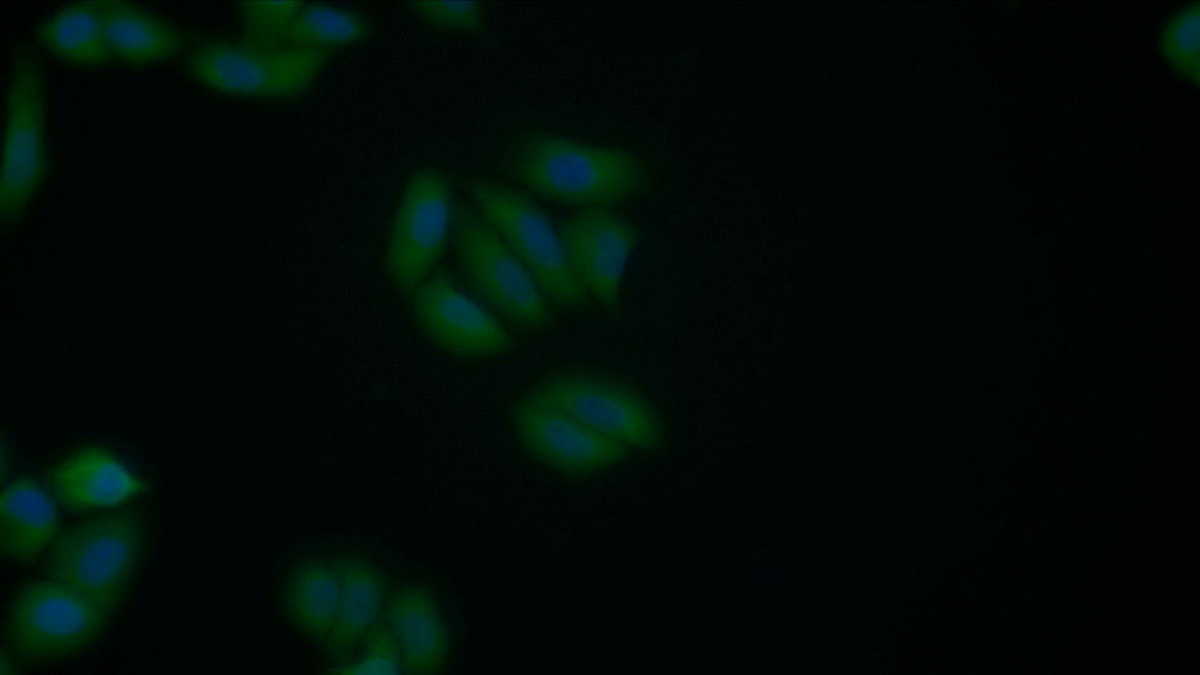 Polyclonal Antibody to Survivin (Surv)