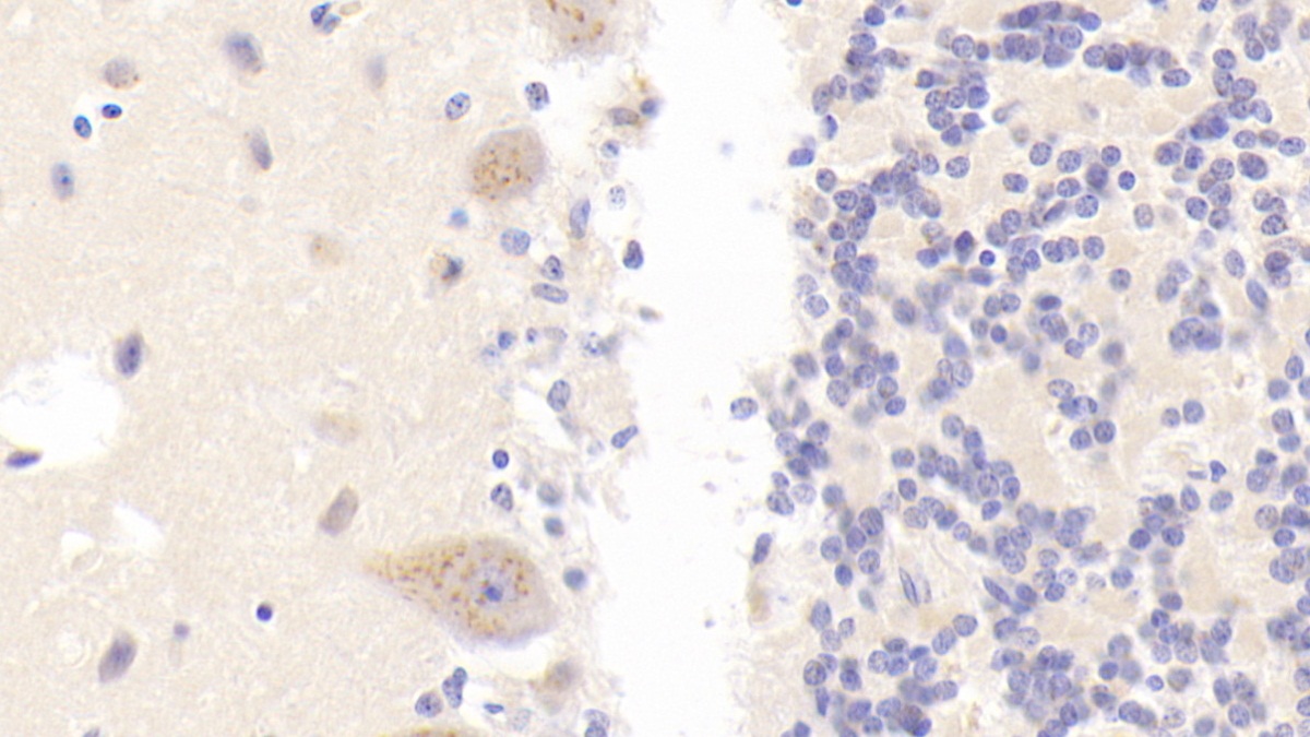 Polyclonal Antibody to Phospholipase B (PLB)