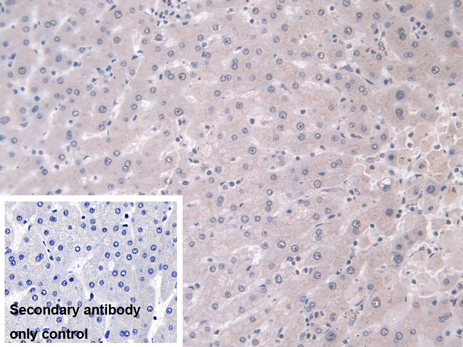 Polyclonal Antibody to Phospholipase D (PLD)